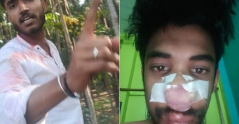 গোবরডাঙ্গায় সাংবাদিক আক্রান্ত,মূল অভিযুক্ত দুষ্কৃতী অধরাই