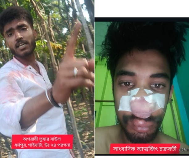 গোবরডাঙ্গায় সাংবাদিক আক্রান্ত,মূল অভিযুক্ত দুষ্কৃতী অধরাই